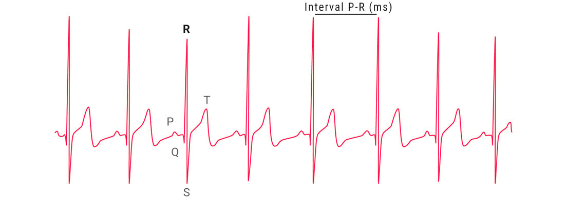 A graph showing a heart rate variability stress test.